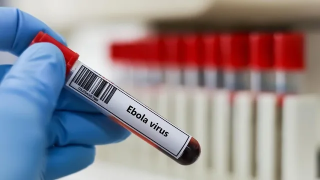 Une main gantée de bleu tient un tube d'échantillon étiqueté virus Ebola, image d'illustration