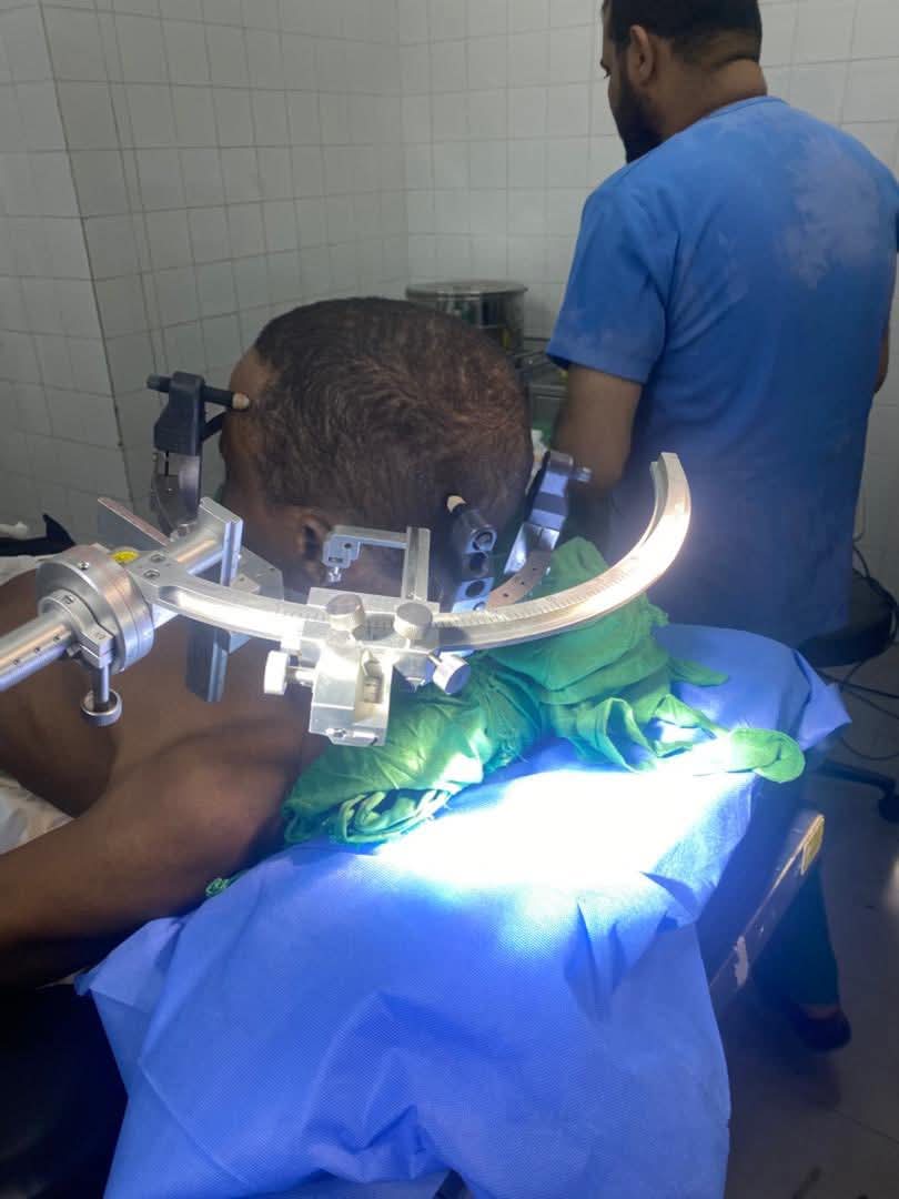 Multiples biopsies stéréotaxiques réalisées au Centre Hospitalier National de Nouakchott : une avancée rare dans la sous-région